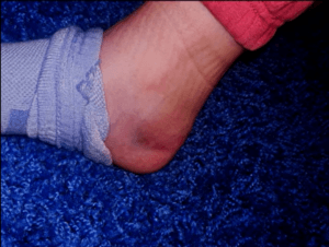 Read more about the article Good and Bad Day in Luge